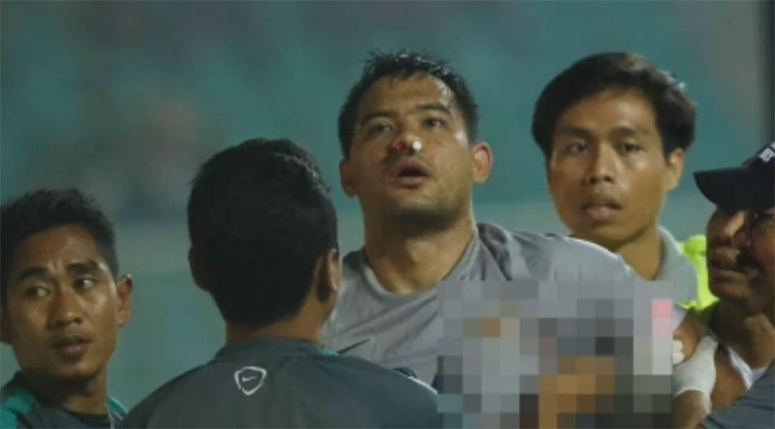 Cedera Tulang Pipi Parah, Andritany Tak Bisa Perkuat Timnas di Asian Games
