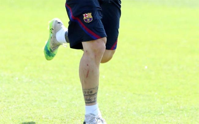 luka di kaki Lionel Messi