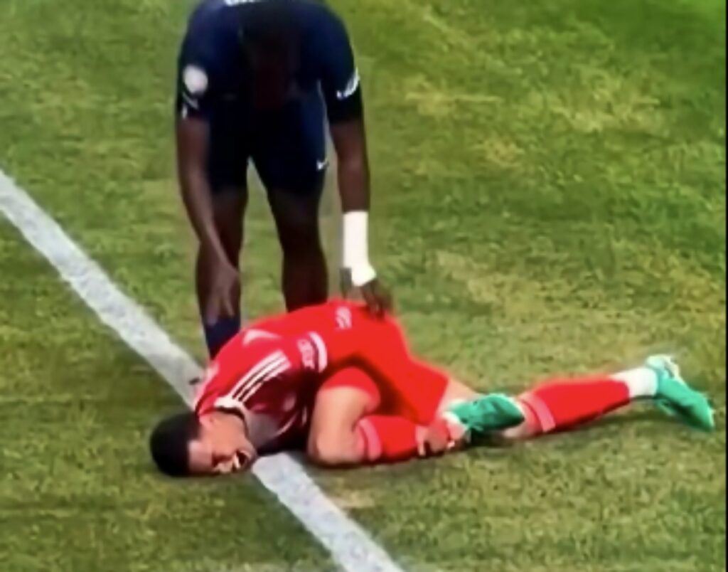Jamal Musiala Cedera Parah, Absen 4-5 Bulan Usai Patah Tulang dan Rusak Ligamen