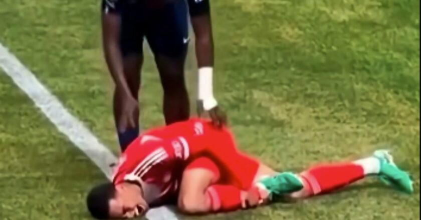 Jamal Musiala Cedera Parah, Absen 4-5 Bulan Usai Patah Tulang dan Rusak Ligamen