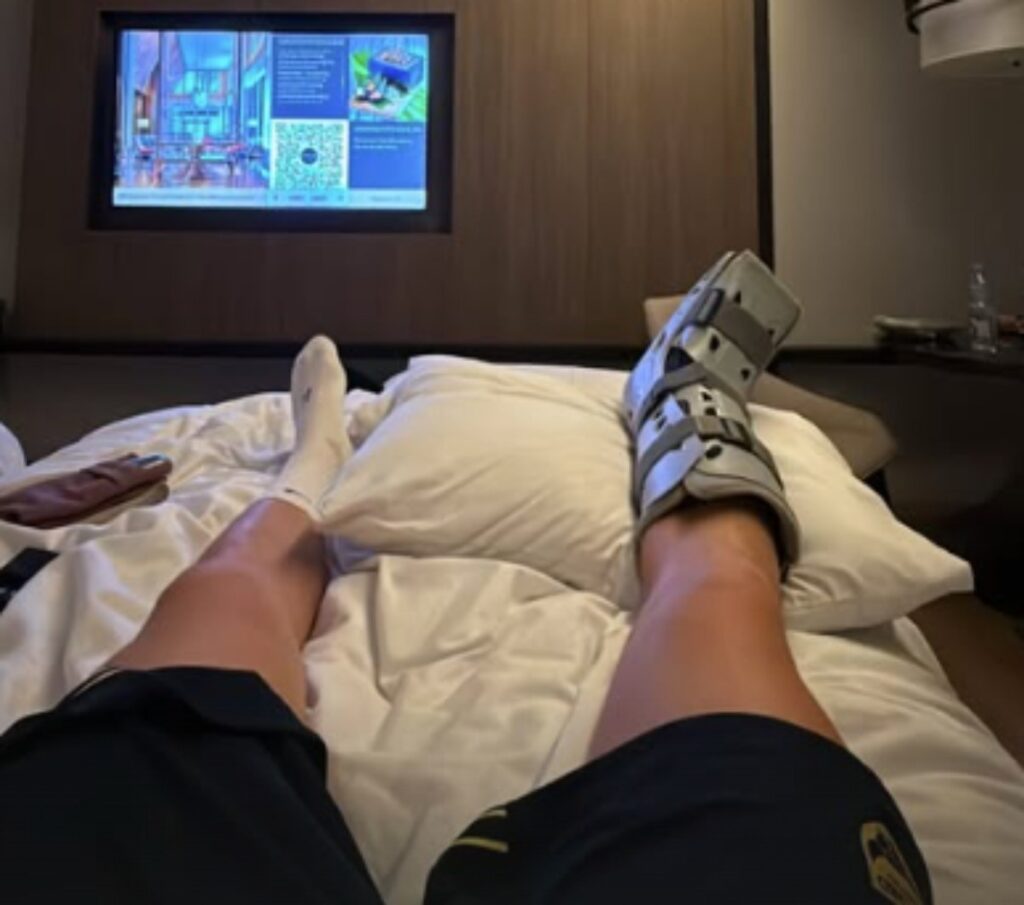 Ole Romeny Posting Foto Kondisi Cedera Kaki Kanan Terkininya